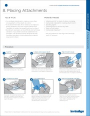 New Invisalign - Quick Start Guide for Cosmetic Dental Braces page 11